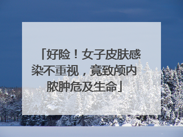 好险！女子皮肤感染不重视，竟致颅内脓肿危及生命
